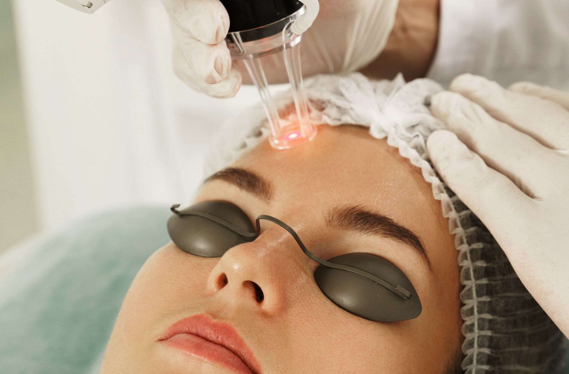 Laser Skin Resurfacing
