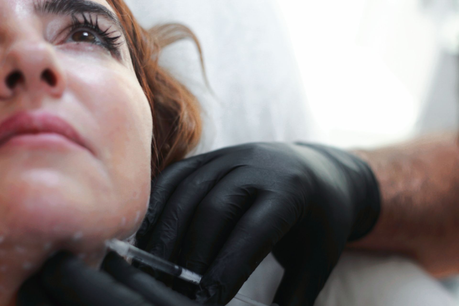 Kybella